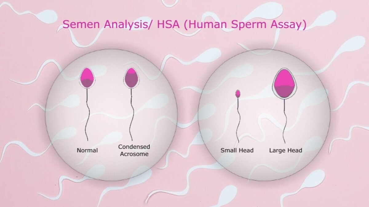 hsa-test-vs-semen-analysis-nucleus-ivf