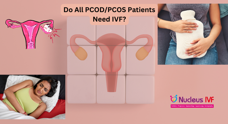 Do All PCOD/PCOS Patients Need IVF?