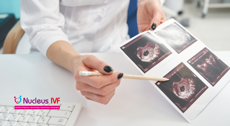 First Trimester Checklist: Things You Must Do After You Get a Positive Test