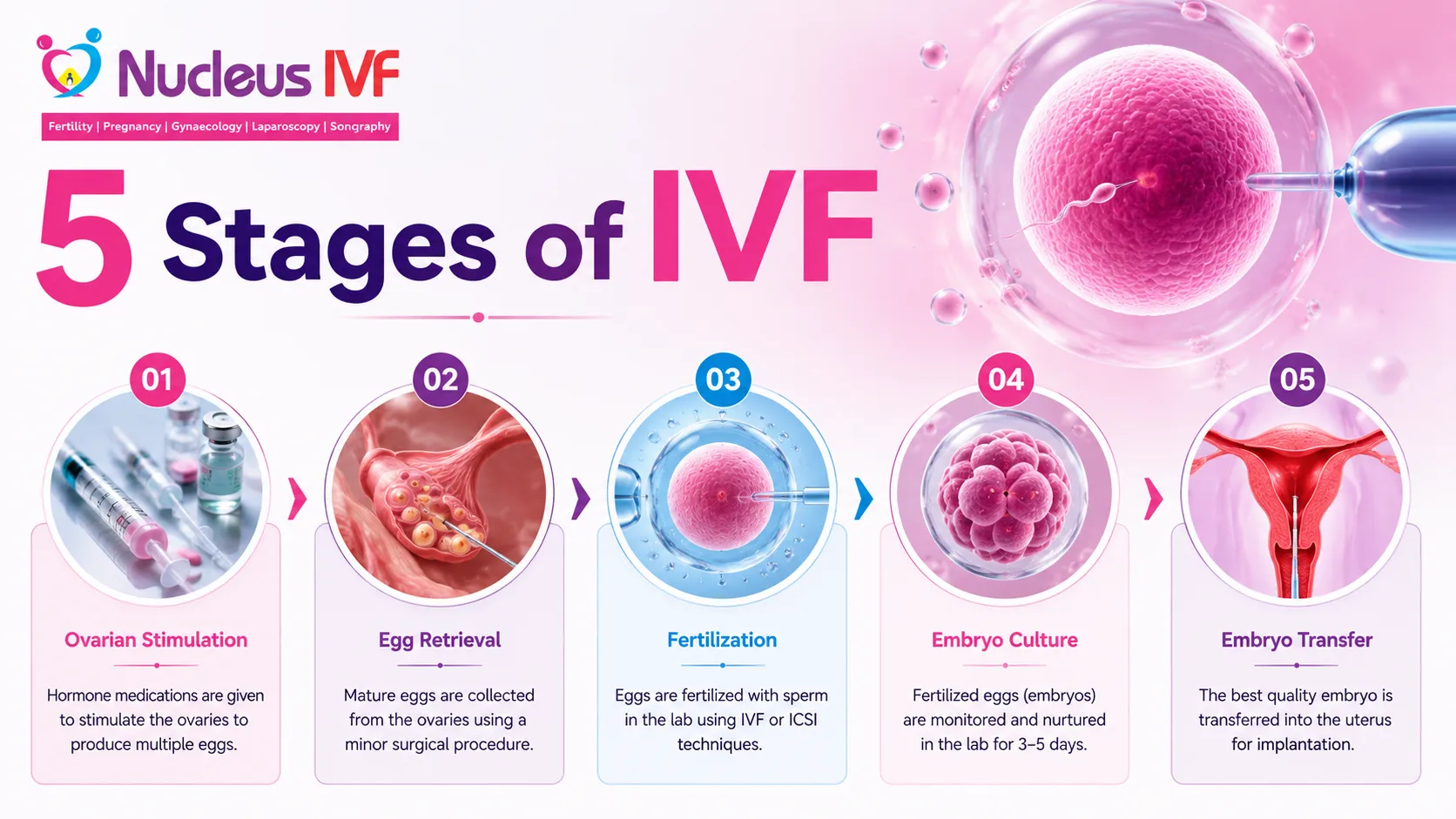 5 Stages of IVF: Complete Step-by-Step IVF Process Guide