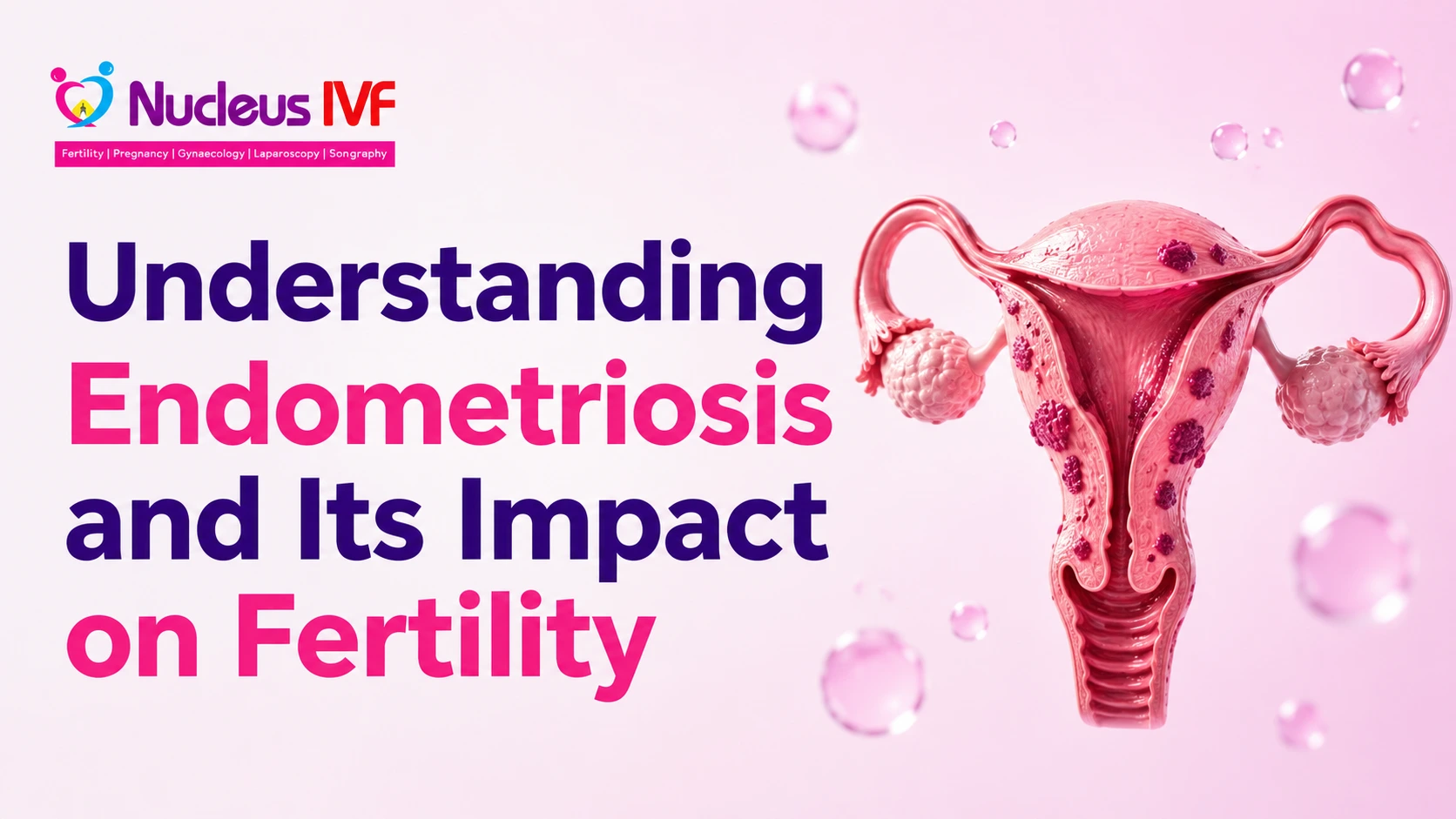 Understanding Endometriosis and Its Impact on Fertility