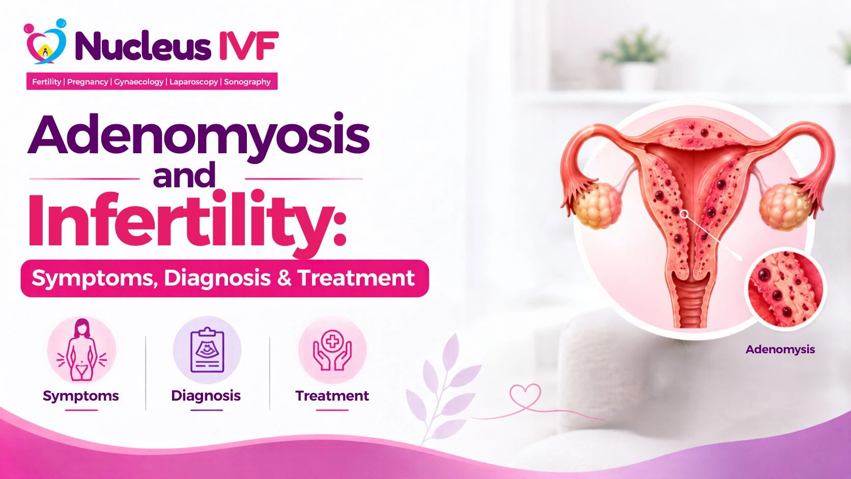 Adenomyosis and Infertility: Symptoms, Diagnosis & Treatment